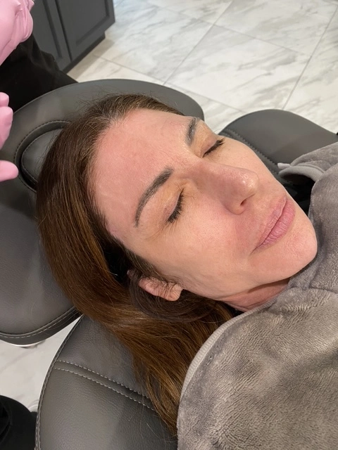 PicoWay eyebrow tattoo removal laser treatment Las Vegas Summerlin brow regret relief