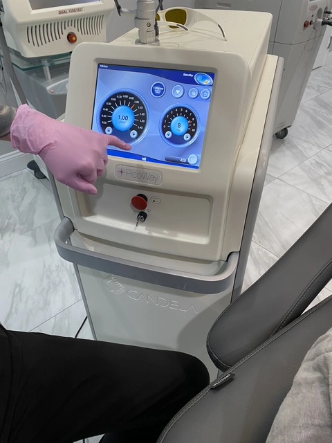 PicoWay laser system advanced eyebrow tattoo removal equipment Las Vegas